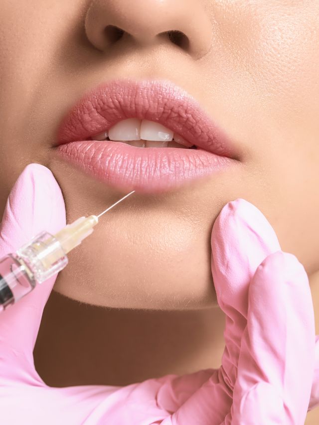 A woman is experiencing swelling and bruising after getting lip fillers.
