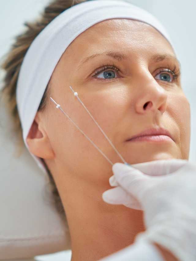 A woman is getting a needle in her face.