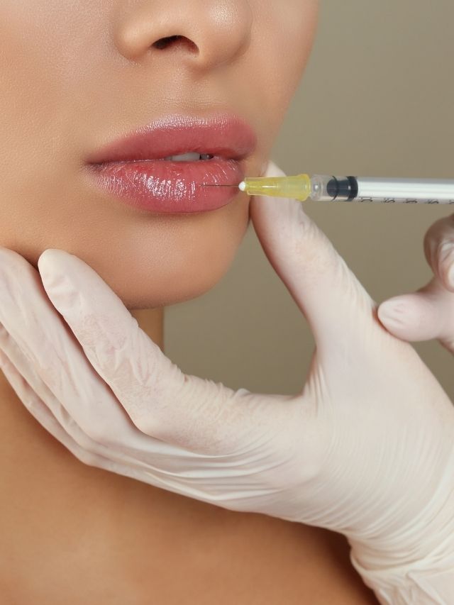 How Long To Wait Between Lip Fillers After Filer Injections
