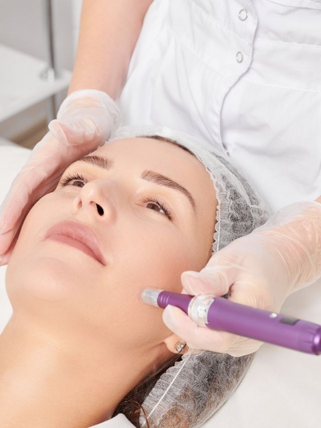 What Does Your Face Look Like After Microneedling?